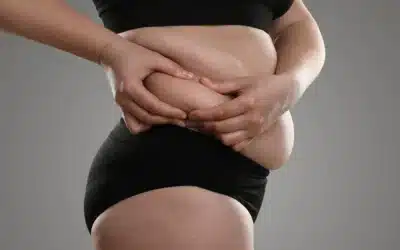 Target & Destroy Fat Cells With CoolSculpting® ELITE